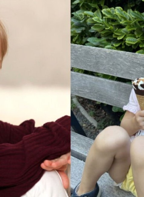 Vaneska alopácia (9)