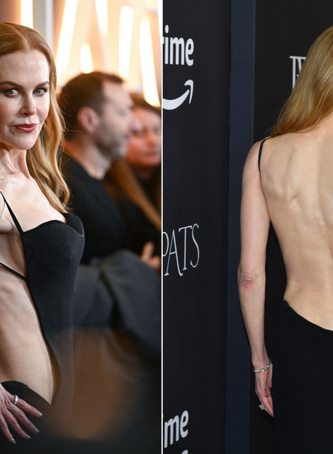 nicole kidman