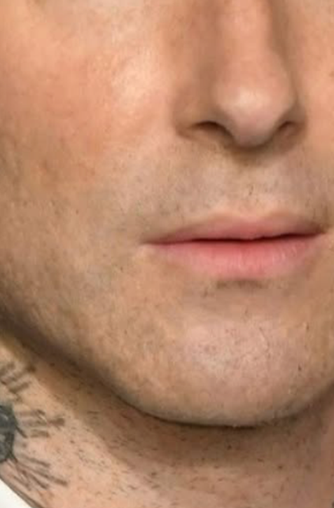 Už aj ON?! Hviezdny spevák ukázal zmenenú tvár, fanúšikovia sa nevedia dohodnúť, čo sa udialo!