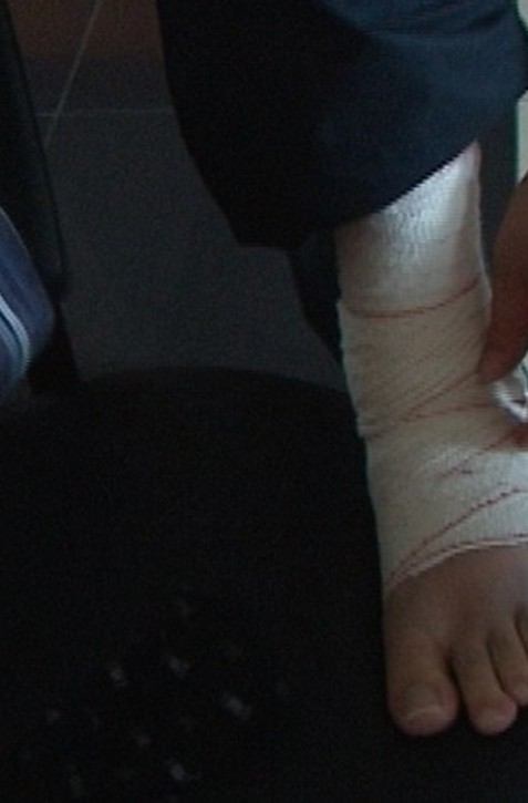 Vytkli ste si členok? Ak počujete tento zvuk, určite sa neliečte sami!