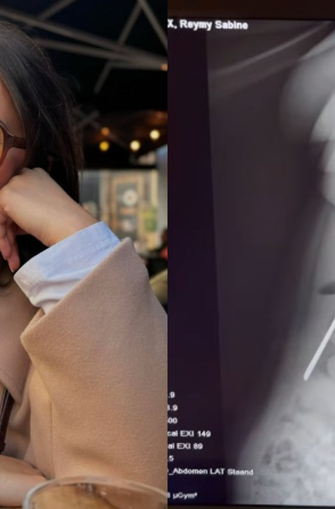 Pozor, na obyčajnú činnosť. Žena pri nej prehltla celú lyžicu