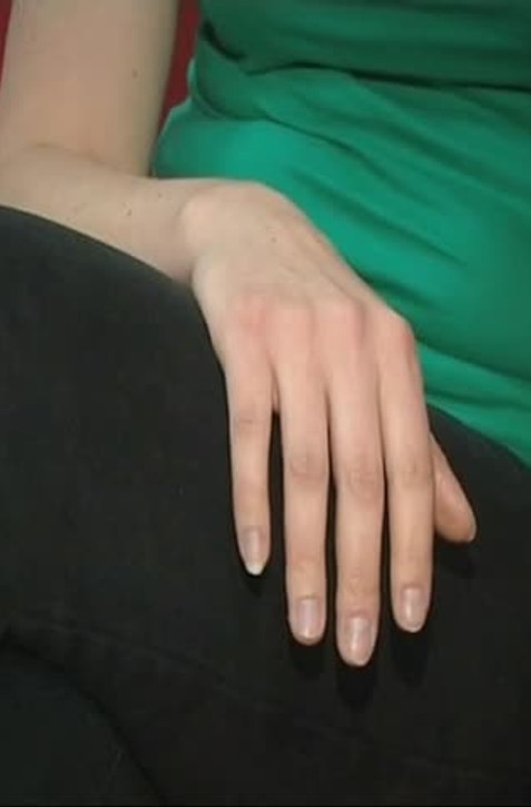 Osamelosť vám môže skutočne "zlomiť srdce". Neuveríte, ktorá generácia ňou najviac trpí