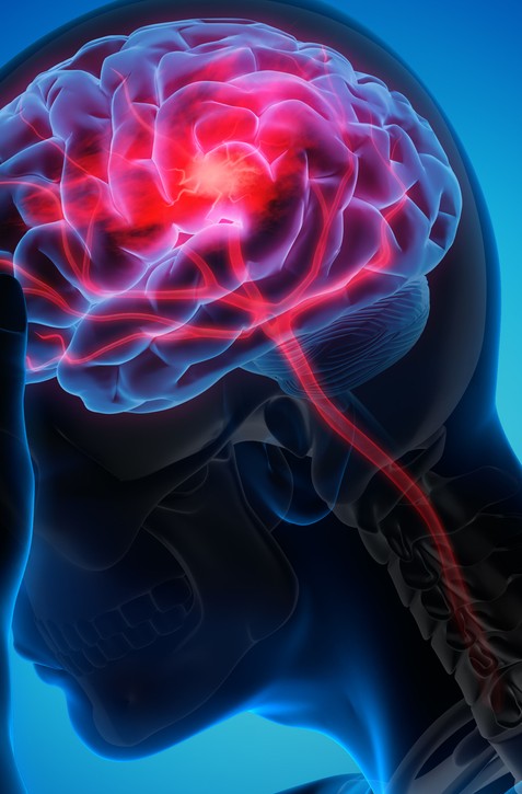 TOTO JE 8 zlých návykov, ktoré poškodzujú váš mozog