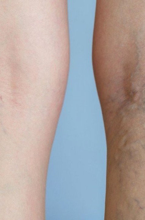 Týchto 12 vecí môžete urobiť pre svoj krvný obeh ešte dnes