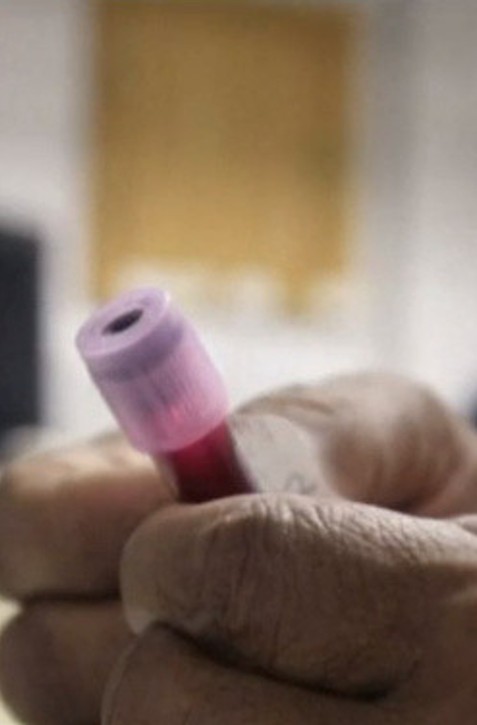 TIETO 3 faktory spôsobujú až polovicu úmrtí na rakovinu: Odstrániť ich môže každý!