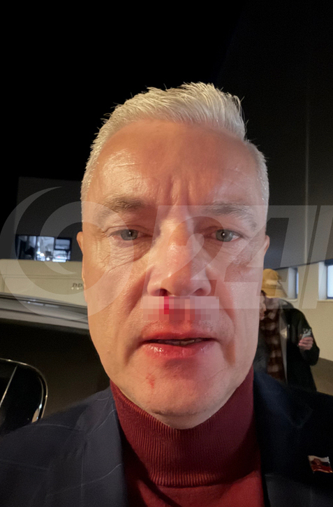 Ferenčák: Fyzicky ma napadli pred dcérou, skončil som na zemi, tiekla mi krv