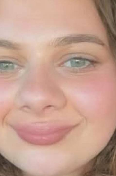Študentku (†19) našli mŕtvu na internáte. Užívala populárny liek na chudnutie