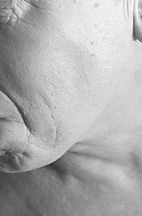 Lekár o nádoroch hlavy a krku: Naši pacienti chodia neskoro, TIETO príznaky si  všímajte!