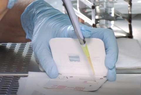 Lekári bojovali o život 9- ročného chlapca, ochorel na chrípku