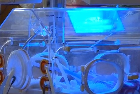 Naživo z inkubátora. Úspešný projekt odštartoval v novozámockej nemocnici