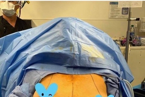 Chrissy Teigen Operácia