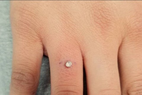 Piercing namiesto prsteňa