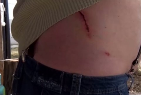 Prechádzka s vnukom sa zmenila na drámu: Muža napadli psy