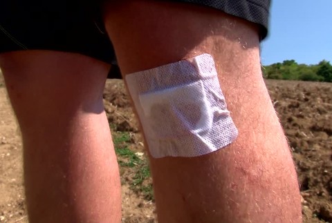 dobodany sršnami6505