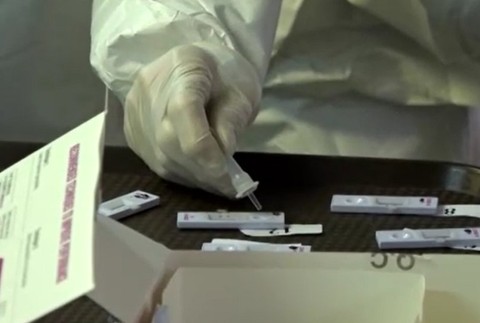 Ľudia pred vyšetrením zatajujú pozitívny test na koronavírus.