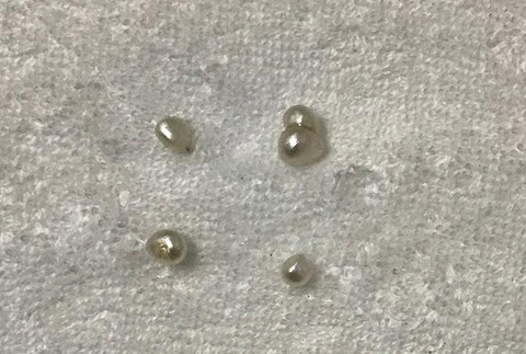 Nečakaný objav. Lastúra s 10 perlami 