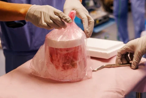 Xenotransplantácia