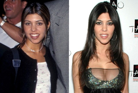 Kourtney Kardashian ako jediná z piatich slávnych sestier priznala plastickú operáciu, a to zväčšenie hrudníka