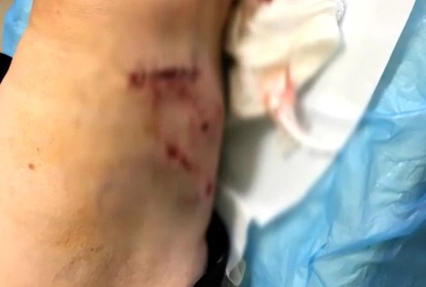 Pani Martu napadol pes