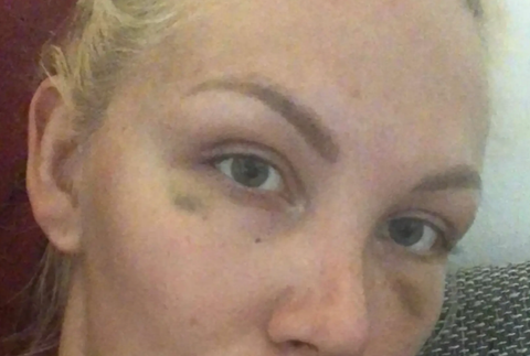 Lia Balanovská po útoku
