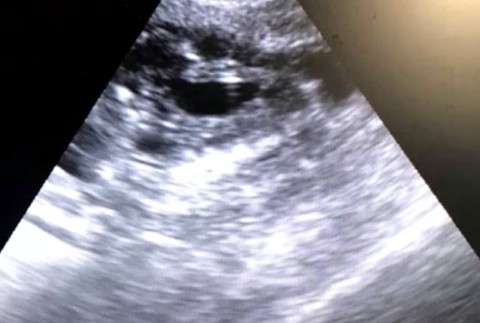 Vodič zrazil gravidnú fenku, ani nezastavil. U veterinárky zomrela