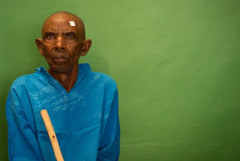 Pred operáciou očná klinika Kabgayi