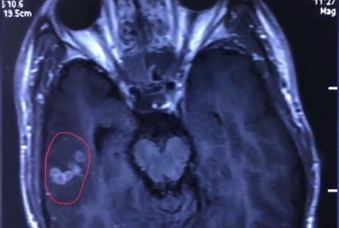 Červ v mozgu Číňana