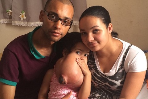 dievčatko s tumorom