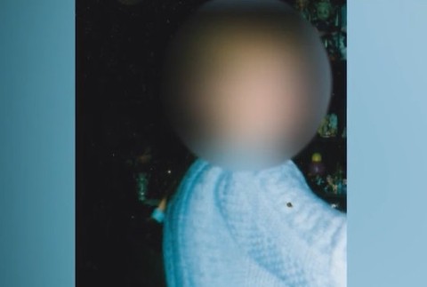 Zomrela na zápal slepého čreva.