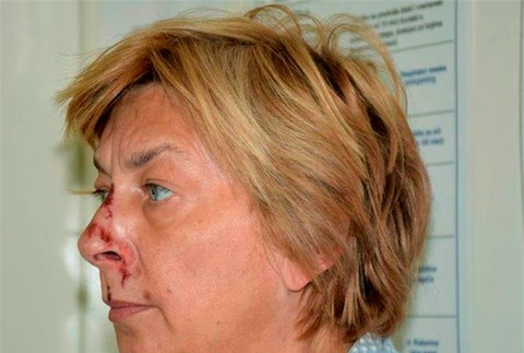 Chorvátsko - Ženu so stratou pamäte identifikovali ako Slovenku