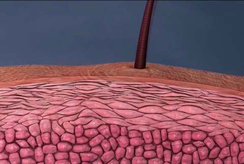 Silné svrbenie a mnohé ťažkosti. Sú choroby, ktoré človek pred okolím ukrývať nedokáže