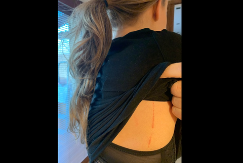 Dcéra Brhela opísala neprimeraný zásah NAKA