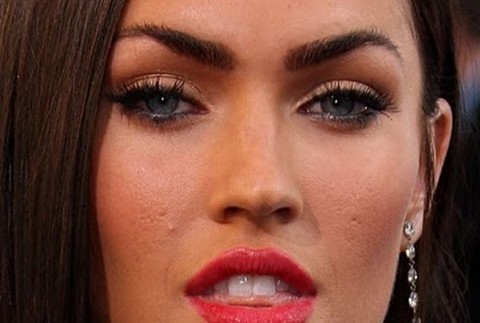 Krásnu Megan trápia najmä male jazvičky na tvári 