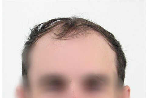 Obvinený strelec z Púchova 