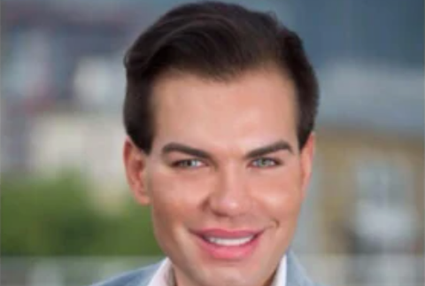 Rodrigo Alves pred plastikami