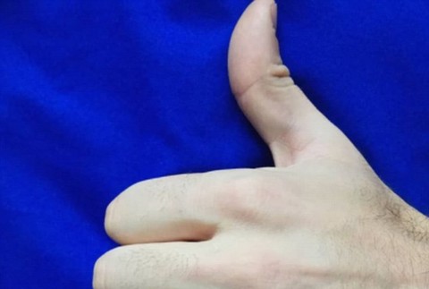 Piercing namiesto prsteňa