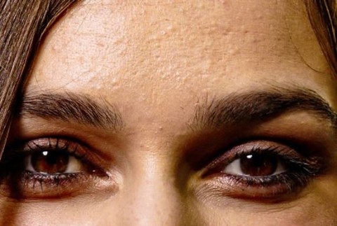 Keira Knightley a jej "krupička" na čele