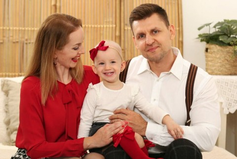 Vaneska alopácia (8)