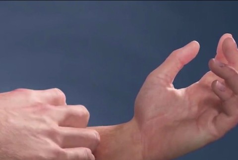 Silné svrbenie a mnohé ťažkosti. Sú choroby, ktoré človek pred okolím ukrývať nedokáže