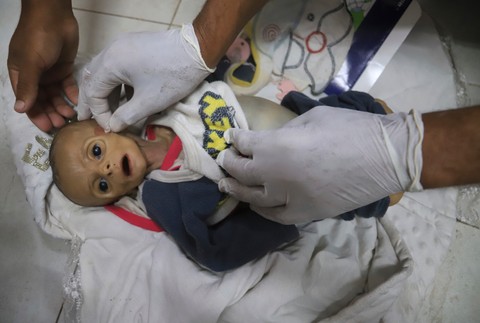 Hladomor v Pásme Gazy