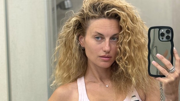 Natália Germáni vystrašila fanúšikov: Záber s holou hlavou medzi nimi vyvolal paniku!