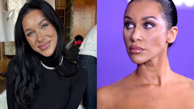 Bianka Rumanová úprimne o lynči na internete: Musela vyhľadať terapeutku! TOTO už neustála