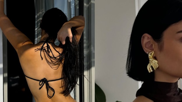V čase, keď sa všetci vracajú k prirodzenosti: Známa Jojkárka otvorene ukázala botox aj výplň pier