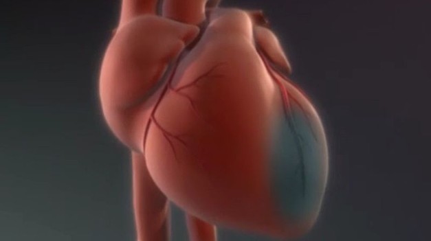 Infarkt u ženy môže vyzerať úplne inak než u muža : Na tieto príznaky si dajte pozor!