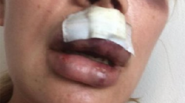 Nielen sexistické názory, ale aj násilnosti?! Známy český boháč údajne zbil expriateľku!
