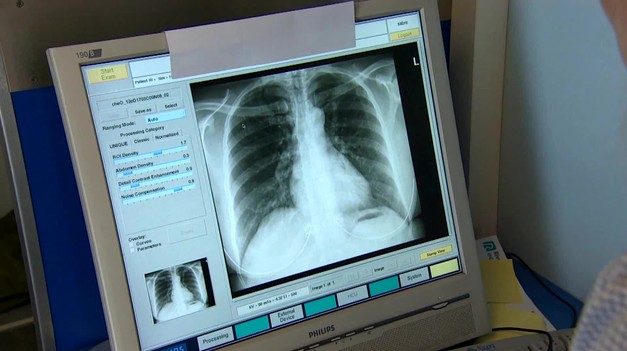 13 ochorení, ktoré ohrozujú vaše pľúca: Čo robiť, ak sa vám ťažko dýcha?