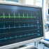 Nová AI číta EKG za dve sekundy. Odhalí choré srdce
