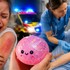 Rodičia, dávajte POZOR: Obľúbená HRAČKA môže spôsobiť vážne popáleniny!