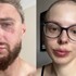 Jakuba zbili pre žltomodré farby na čiapke. Chcel vyzbierať peniaze pre partnerku s rakovinou