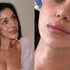 Bianka Rumanová opäť mení tvár: Fanúšikom ukázala zákrok, ktorý nie je pre SLABÉ povahy!